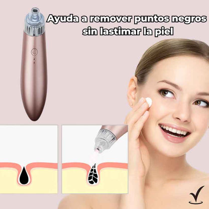 PurePore Pro™ -  Limpia tus poros sin maltratar tu piel